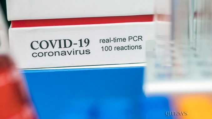 Ελλάδα: Πλαφόν στην τιμή του μοριακού (PCR) τεστ