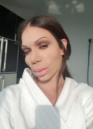 Κατερίνα Στικούδη – «Botox»